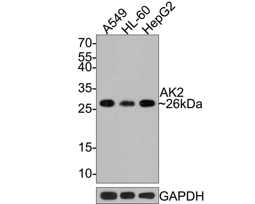 Western blot analysis on different lysates with NBP3-32013 at 1/1,000 dilution. Lane 1: A549 cell lysate Lane 2: HL-60 cell lysate Lane 3: HepG2 cell lysate Lysates/proteins at 10 µg/Lane. Predicted band size: 26 kDa Observed band size: 26 kDa Exposure time: 2 minutes; 12 % SDS-PAGE gel. Proteins were transferred to a PVDF membrane and blocked with 5% NFDM/TBST for 1 hour at room temperature. The primary antibody AK2 at 1/1,000 dilution was used in 5% NFDM/TBST at room temperature for 2 hours. Goat Anti-Rabbit IgG [HRP] Secondary Antibody at 1:300,000 dilution was used for 1 hour at room temperature.