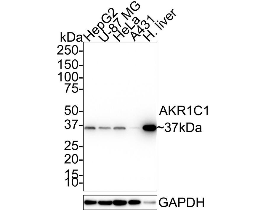 Western blot analysis on different lysates with NBP3-32014 at 1/1,000 dilution. Lane 1: HepG2 cell lysate (20 µg/Lane) Lane 2: U-87 MG cell lysate (20 µg/Lane) Lane 3: HeLa cell lysate (20 µg/Lane) Lane 4: A431 cell lysate (20 µg/Lane) Lane 5: Human liver tissue lysate (40 µg/Lane) Predicted band size: 37 kDa Observed band size: 37 kDa Exposure time: 30 seconds; 4-20% SDS-PAGE gel. Proteins were transferred to a PVDF membrane and blocked with 5% NFDM/TBST for 1 hour at room temperature. NBP3-32014 at 1/1,000 dilution was used in 5% NFDM/TBST at room temperature for 2 hours. Goat anti-Mouse IgG [HRP] at 1/100,000 dilution was used for 1 hour at room temperature.