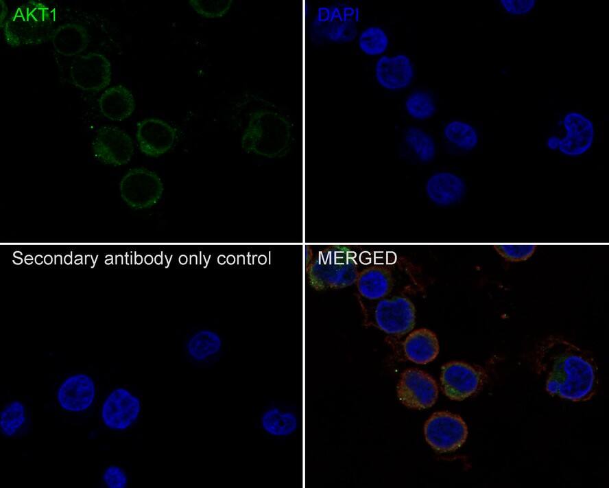 Immunocytochemistry/ Immunofluorescence: AKT1 Antibody (PSH0-50) [NBP3-32016] - Immunocytochemistry analysis of Jurkat cells labeling AKT1 with Rabbit anti-AKT1 antibody (NBP3-32016) at 1/50 dilution. Cells were fixed in 4% paraformaldehyde for 10 minutes at 37 ℃, permeabilized with 0.05% Triton X-100 in PBS for 20 minutes, and then blocked with 2% negative goat serum for 30 minutes at room temperature. Cells were then incubated with Rabbit anti-AKT1 antibody (NBP3-32016) at 1/50 dilution in 2% negative goat serum overnight at 4 ℃. Goat Anti-Rabbit IgG H&L (iFluor™ 488) was used as the secondary antibody at 1/1,000 dilution. Nuclear DNA was labelled in blue with DAPI. Beta tubulin (red) was stained at 1/200 dilution overnight at +4℃. Goat Anti-Mouse IgG H&L (iFluor™ 594) was used as the secondary antibody at 1/1,000 dilution.