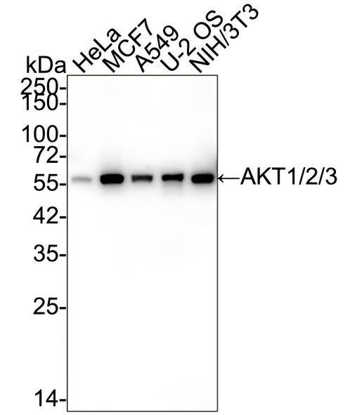 Western blot analysis on different lysates with NBP3-32017 at 1/2,000 dilution and competitor's antibody at 1/1,000 dilution. Lane 1: HeLa cell lysate Lane 2: MCF7 cell lysate Lane 3: A549 cell lysate Lane 4: U-2 OS cell lysate Lane 5: NIH/3T3 cell lysate Lysates/proteins at 15 µg/Lane. Predicted band size: 56 kDa Observed band size: 56 kDa Exposure time: 30 seconds; 4-20% SDS-PAGE gel. Proteins were transferred to a PVDF membrane and blocked with 5% NFDM/TBST for 1 hour at room temperature. NBP3-32017 at 1/2,000 dilution and competitor's antibody at 1/1,000 dilution were used in 5% NFDM/TBST at 4℃ overnight. Goat Anti-Rabbit IgG [HRP] Secondary Antibody at 1/50,000 dilution was used for 1 hour at room temperature.