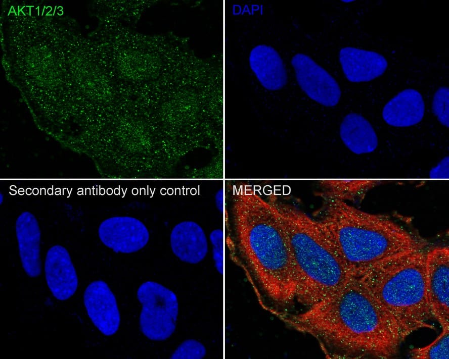 Immunocytochemistry/ Immunofluorescence: AKT1/2/3 Antibody (JE75-09) [NBP3-32017] - Immunocytochemistry analysis of MCF7 cells labeling AKT1/2/3 with Rabbit anti-AKT1/2/3 antibody (NBP3-32017) at 1/100 dilution. Cells were fixed in 100% precooled methanol for 5 minutes at room temperature, then blocked with 1% BSA in 10% negative goat serum for 1 hour at room temperature. Cells were then incubated with Rabbit anti-AKT1/2/3 antibody (NBP3-32017) at 1/100 dilution in 1% BSA in PBST overnight at 4 ℃. Goat Anti-Rabbit IgG H&L (iFluor™ 488) was used as the secondary antibody at 1/1,000 dilution. PBS instead of the primary antibody was used as the secondary antibody only control. Nuclear DNA was labelled in blue with DAPI. Beta tubulin (red) was stained at 1/100 dilution overnight at +4℃. Goat Anti-Mouse IgG H&L (iFluor™ 594) was used as the secondary antibody at 1/1,000 dilution.