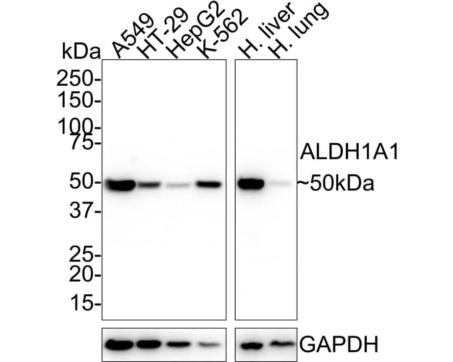 Western Blot: Aldehyde Dehydrogenase 1-A1/ALDH1A1 Antibody (8F1-R) [NBP3-32019] - Western blot analysis of Aldehyde Dehydrogenase 1-A1/ALDH1A1 on different lysates with Mouse anti-Aldehyde Dehydrogenase 1-A1/ALDH1A1 antibody (NBP3-32019) at 1/1,000 dilution. Lane 1: A549 cell lysate (20 ug/Lane) Lane 2: HT-29 cell lysate (20 ug/Lane) Lane 3: HepG2 cell lysate (20 ug/Lane) Lane 4: K-562 cell lysate (20 ug/Lane) Lane 5: Human liver tissue lysate (40 ug/Lane) Lane 6: Human lung tissue lysate (40 ug/Lane) Predicted band size: 55 kDa Observed band size: 50 kDa Exposure time: 1 minute; 4-20% SDS-PAGE gel. Proteins were transferred to a PVDF membrane and blocked with 5% NFDM/TBST for 1 hour at room temperature. The primary antibody (NBP3-32019) at 1/1,000 dilution was used in 5% NFDM/TBST at room temperature for 2 hours. Goat Anti-Mouse IgG - HRP Secondary Antibody at 1/50,000 dilution was used for 1 hour at room temperature.