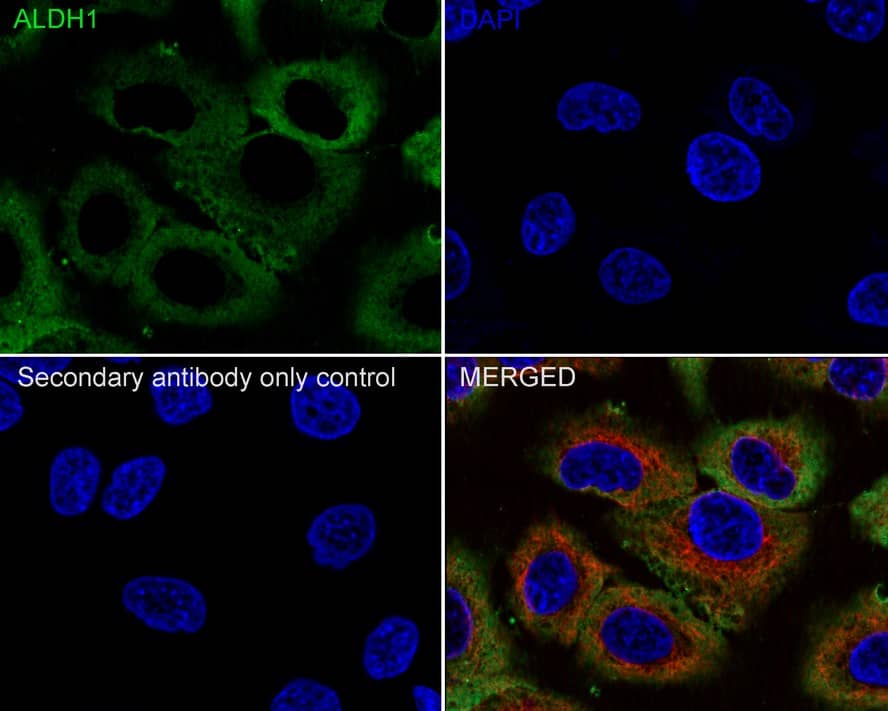 Immunocytochemistry/ Immunofluorescence: Aldehyde Dehydrogenase 1-A1/ALDH1A1 Antibody (8F1-R) [NBP3-32019] - Immunocytochemistry analysis of A549 cells labeling Aldehyde Dehydrogenase 1-A1/ALDH1A1 with Mouse anti-Aldehyde Dehydrogenase 1-A1/ALDH1A1 antibody (NBP3-32019) at 1/100 dilution. Cells were fixed in 4% paraformaldehyde for 20 minutes at room temperature, permeabilized with 0.1% Triton X-100 in PBS for 5 minutes at room temperature, then blocked with 1% BSA in 10% negative goat serum for 1 hour at room temperature. Cells were then incubated with Mouse anti-Aldehyde Dehydrogenase 1-A1/ALDH1A1 antibody (NBP3-32019) at 1/100 dilution in 1% BSA in PBST overnight at 4 ℃. Goat Anti-Mouse IgG H&L (iFluor™ 488) was used as the secondary antibody at 1/1,000 dilution. PBS instead of the primary antibody was used as the secondary antibody only control. Nuclear DNA was labelled in blue with DAPI. beta Tubulin (red) was stained at 1/100 dilution overnight at +4℃. Goat Anti-Rabbit IgG H&L (iFluor™ 594) were used as the secondary antibody at 1/1,000 dilution.