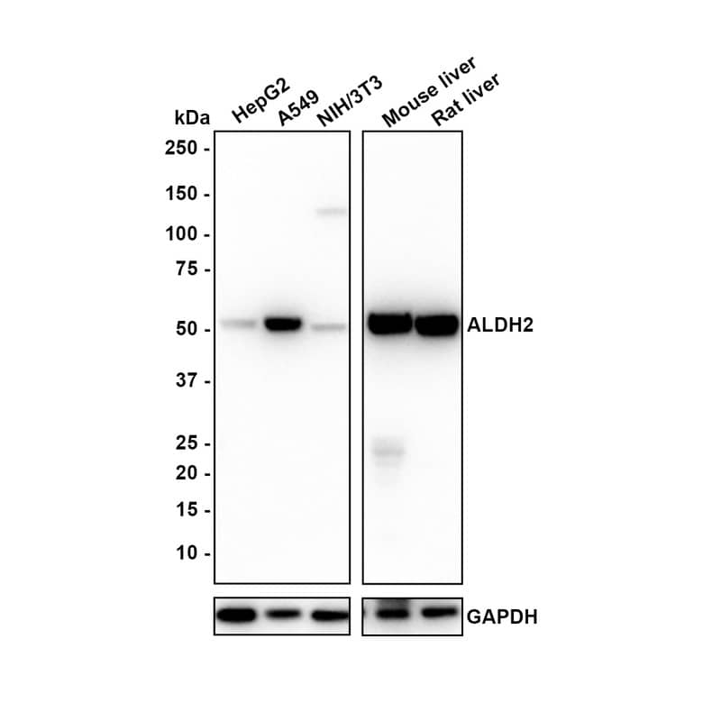 Western blot analysis on different lysates with NBP3-32021 at 1/1,000 dilution. Lane 1: HepG2 cell lysate (20 µg/Lane) Lane 2: A549 cell lysate (20 µg/Lane) Lane 3: NIH/3T3 cell lysate (20 µg/Lane) Lane 4: Mouse liver tissue lysate (40 µg/Lane) Lane 5: Rat liver tissue lysate (40 µg/Lane) Predicted band size: 56 kDa Observed band size: 50 kDa Exposure time: 40 seconds; 4-20% SDS-PAGE gel. Proteins were transferred to a PVDF membrane and blocked with 5% NFDM/TBST for 1 hour at room temperature. NBP3-32021 at 1/1,000 dilution was used in 5% NFDM/TBST at room temperature for 2 hours. Goat anti-Mouse IgG [HRP] at 1/100,000 dilution was used for 1 hour at room temperature.