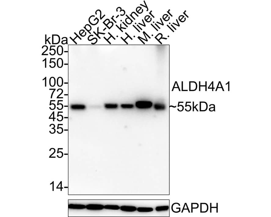 Western Blot: ALDH4A1 Antibody (7E2-R) [NBP3-32024] - Western blot analysis of ALDH4A1 on different lysates with Mouse anti-ALDH4A1 antibody (NBP3-32024) at 1/5,000 dilution. Lane 1: HepG2 cell lysate (20 ug/Lane) Lane 2: SK-Br-3 cell lysate (20 ug/Lane) Lane 3: Human kidney tissue lysate (40 ug/Lane) Lane 4: Human liver tissue lysate (40 ug/Lane) Lane 5: Mouse liver tissue lysate (40 ug/Lane) Lane 6: Rat liver tissue lysate (40 ug/Lane) Predicted band size: 62 kDa Observed band size: 55 kDa Exposure time: 1 minute 13 seconds; 4-20% SDS-PAGE gel. Proteins were transferred to a PVDF membrane and blocked with 5% NFDM/TBST for 1 hour at room temperature. The primary antibody (NBP3-32024) at 1/5,000 dilution was used in 5% NFDM/TBST at 4℃ overnight. Goat Anti-Mouse IgG - HRP Secondary Antibody at 1/50,000 dilution was used for 1 hour at room temperature.