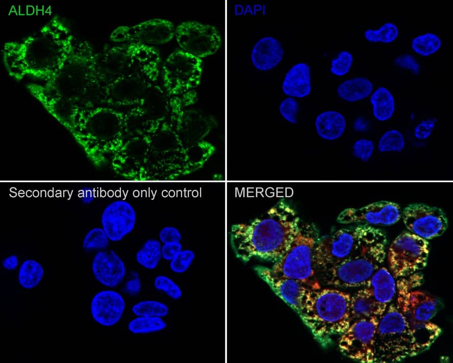 Immunocytochemistry/ Immunofluorescence: ALDH4A1 Antibody (7E2-R) [NBP3-32024] - Immunocytochemistry analysis of HepG2 cells labeling ALDH4A1 with Rabbit anti-ALDH4A1 antibody (NBP3-32024) at 1/100 dilution. Cells were fixed in 4% paraformaldehyde for 20 minutes at room temperature, permeabilized with 0.1% Triton X-100 in PBS for 5 minutes at room temperature, then blocked with 1% BSA in 10% negative goat serum for 1 hour at room temperature. Cells were then incubated with Rabbit anti-ALDH4A1 antibody (NBP3-32024) at 1/100 dilution in 1% BSA in PBST overnight at 4 ℃. Goat Anti-Rabbit IgG H&L (iFluor™ 488) was used as the secondary antibody at 1/1,000 dilution. PBS instead of the primary antibody was used as the secondary antibody only control. Counterstained with Mitotracker. Nuclear DNA was labelled in blue with DAPI.