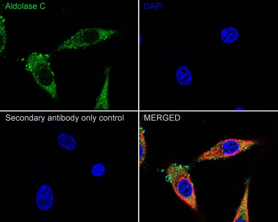 Immunocytochemistry/ Immunofluorescence: Aldolase C Antibody (PSH01-81) [NBP3-32025] - Immunocytochemistry analysis of U-87 MG cells labeling Aldolase C with Rabbit anti-Aldolase C antibody (NBP3-32025) at 1/100 dilution. Cells were fixed in 4% paraformaldehyde for 20 minutes at room temperature, permeabilized with 0.1% Triton X-100 in PBS for 5 minutes at room temperature, then blocked with 1% BSA in 10% negative goat serum for 1 hour at room temperature. Cells were then incubated with Rabbit anti-Aldolase C antibody (NBP3-32025) at 1/100 dilution in 1% BSA in PBST overnight at 4 ℃. Goat Anti-Rabbit IgG H&L (iFluor™ 488) was used as the secondary antibody at 1/1,000 dilution. PBS instead of the primary antibody was used as the secondary antibody only control. Nuclear DNA was labelled in blue with DAPI. Beta tubulin (red) was stained at 1/100 dilution overnight at +4℃. Goat Anti-Mouse IgG H&L (iFluor™ 594) was used as the secondary antibody at 1/1,000 dilution.