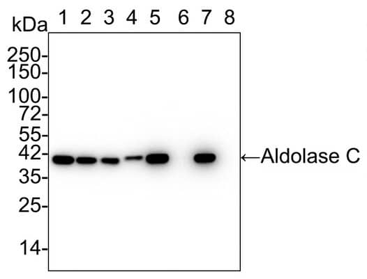 Western Blot: Aldolase C Antibody (PSH01-81) [NBP3-32025] - Western blot analysis of Aldolase C on different lysates with Rabbit anti-Aldolase C antibody (NBP3-32025) at 1/2,000 dilution.Lane 1: U-87 MG cell lysateLane 2: RAW264.7 cell lysateLane 3: C6 cell lysateLane 4: Human brain tissue lysateLane 5: Mouse brain tissue lysateLane 6: Mouse pancreas tissue lysate (negative)Lane 7: Rat brain tissue lysateLane 8: Rat pancreas tissue lysate (negative)Lysates/proteins at 20 µg/Lane.Predicted band size: 40 kDaObserved band size: 40 kDaExposure time: 19 seconds;4-20% SDS-PAGE gel.Proteins were transferred to a PVDF membrane and blocked with 5% NFDM/TBST for 1 hour at room temperature. The primary antibody at 1/2,000 dilution was used in 5% NFDM/TBST at 4℃ overnight. Goat Anti-Rabbit IgG - HRP Secondary Antibody at 1/50,000 dilution was used for 1 hour at room temperature.