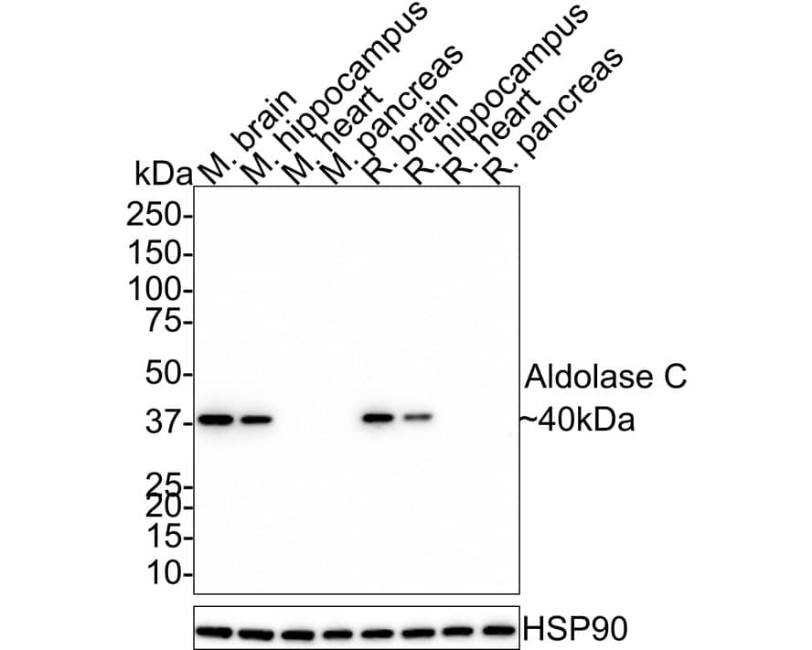 Western Blot: Aldolase C Antibody (PSH01-82) [NBP3-32026] - Western blot analysis of Aldolase C on different lysates with Rabbit anti-Aldolase C antibody (NBP3-32026) at 1/1,000 dilution. Lane 1: Mouse brain tissue lysate Lane 2: Mouse hippocampus tissue lysate Lane 3: Mouse heart tissue lysate (low expression) Lane 4: Mouse pancreas tissue lysate (negative control) Lane 5: Rat brain tissue lysate Lane 6: Rat hippocampus tissue lysate Lane 7: Rat heart tissue lysate (low expression) Lane 8: Rat pancreas tissue lysate (negative control) Lysates/proteins at 20 ug/Lane. Predicted band size: 40 kDa Observed band size: 40 kDa Exposure time: 3 minutes; 4-20% SDS-PAGE gel. Proteins were transferred to a PVDF membrane and blocked with 5% NFDM/TBST for 1 hour at room temperature. The primary antibody (NBP3-32026) at 1/1,000 dilution was used in 5% NFDM/TBST at 4℃ overnight. Goat Anti-Rabbit IgG - HRP Secondary Antibody at 1/50,000 dilution was used for 1 hour at room temperature.