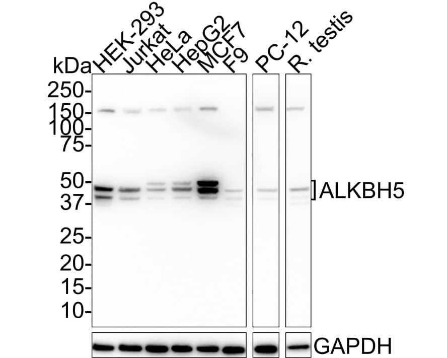 Western Blot: ALKBH5 Antibody (PSH01-16) [NBP3-32027] - Western blot analysis of ALKBH5 on different lysates with Rabbit anti-ALKBH5 antibody (NBP3-32027) at 1/1,000 dilution. Lane 1: HEK-293 cell lysate (20 ug/Lane) Lane 2: Jurkat cell lysate (20 ug/Lane) Lane 3: HeLa cell lysate (20 ug/Lane) Lane 4: HepG2 cell lysate (20 ug/Lane) Lane 5: MCF7 cell lysate (20 ug/Lane) Lane 6: F9 cell lysate (20 ug/Lane) Lane 7: PC-12 cell lysate (20 ug/Lane) Lane 8: Rat testis tissue lysate (40 ug/Lane) Predicted band size: 44 kDa Observed band size: 35~44 kDa Exposure time: 30 seconds; 4-20% SDS-PAGE gel. Proteins were transferred to a PVDF membrane and blocked with 5% NFDM/TBST for 1 hour at room temperature. The primary antibody (NBP3-32027) at 1/1,000 dilution was used in 5% NFDM/TBST at room temperature for 2 hours. Goat Anti-Rabbit IgG - HRP Secondary Antibody at 1:100,000 dilution was used for 1 hour at room temperature.