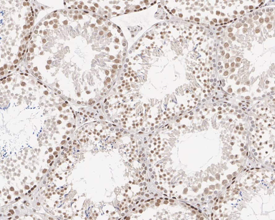 Immunohistochemistry: ALKBH5 Antibody (PSH01-16) [NBP3-32027] - Immunohistochemical analysis of paraffin-embedded mouse testis tissue with Rabbit anti-ALKBH5 antibody (NBP3-32027) at 1/2,000 dilution. The section was pre-treated using heat mediated antigen retrieval with sodium citrate buffer (pH 6.0) for 2 minutes. The tissues were blocked in 1% BSA for 20 minutes at room temperature, washed with ddH2O and PBS, and then probed with the primary antibody (NBP3-32027) at 1/2,000 dilution for 1 hour at room temperature. The detection was performed using an HRP conjugated compact polymer system. DAB was used as the chromogen. Tissues were counterstained with hematoxylin and mounted with DPX.