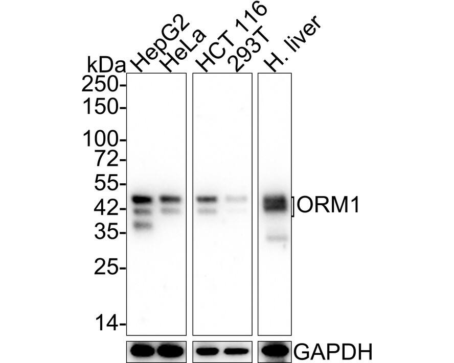 Western blot analysis on different lysates with NBP3-32028 at 1/1,000 dilution. Lane 1: HepG2 cell lysate (20 µg/Lane) Lane 2: HeLa cell lysate (20 µg/Lane) Lane 3: HCT 116 cell lysate (20 µg/Lane) Lane 4: 293T cell lysate (20 µg/Lane) Lane 5: Human liver tissue lysate (40 µg/Lane) Predicted band size: 24 kDa Observed band size: 37/45 kDa Exposure time: 43 seconds; 4-20% SDS-PAGE gel. Proteins were transferred to a PVDF membrane and blocked with 5% NFDM/TBST for 1 hour at room temperature. NBP3-32028 at 1/1,000 dilution was used in 5% NFDM/TBST at 4℃ overnight. Goat anti-Mouse IgG [HRP] at 1/50,000 dilution was used for 1 hour at room temperature.