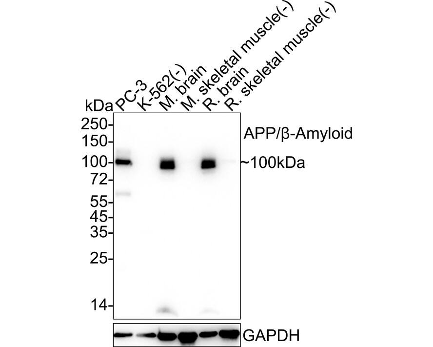 Western blot analysis on different lysates with NBP3-32034 at 1/5,000 dilution. Lane 1: PC-3 cell lysate Lane 2: K-562 cell lysate (negative) Lane 3: Mouse brain tissue lysate Lane 4: Mouse skeletal muscle tissue lysate (negative) Lane 5: Rat brain tissue lysate Lane 6: Rat skeletal muscle tissue lysate (negative) Lysates/proteins at 20 µg/Lane. Predicted band size: 87 kDa Observed band size: 100 kDa Exposure time: 20 seconds;  4-20% SDS-PAGE gel. Proteins were transferred to a PVDF membrane and blocked with 5% NFDM/TBST for 1 hour at room temperature. NBP3-32034 at 1/5,000 dilution was used in 5% NFDM/TBST at 4℃ overnight. Goat Anti-Rabbit IgG [HRP] Secondary Antibody at 1/50,000 dilution was used for 1 hour at room temperature.
