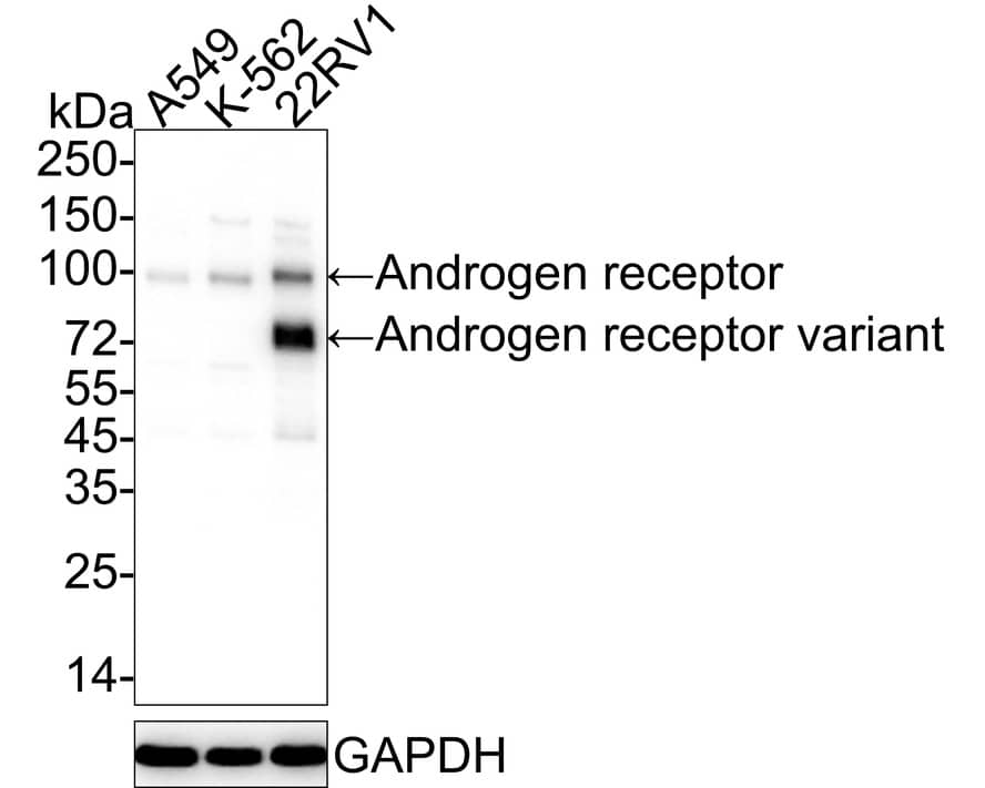 Western blot analysis on different lysates with NBP3-32035 at 1/1,000 dilution. Lane 1: A549 cell lysate Lane 2: K-562 cell lysate Lane 3: 22RV1 cell lysate Lysates/proteins at 10 µg/Lane. Predicted band size: 99 kDa Observed band size: 99/75 kDa Exposure time: 10 seconds; 4-20% SDS-PAGE gel. Proteins were transferred to a PVDF membrane and blocked with 5% NFDM/TBST for 1 hour at room temperature. NBP3-32035 at 1/1,000 dilution was used in 5% NFDM/TBST at 4℃ overnight. Goat Anti-Rabbit IgG [HRP] Secondary Antibody at 1/50,000 dilution was used for 1 hour at room temperature.