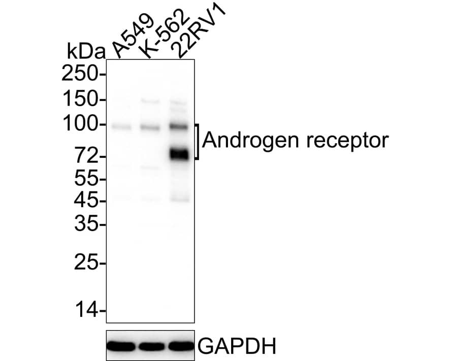 Western Blot: Androgen R/NR3C4 Antibody (PO00-29) [NBP3-32035] - Western blot analysis of Androgen R/NR3C4 on different lysates with Rabbit anti-Androgen R/NR3C4 antibody (NBP3-32035) at 1/1,000 dilution. Lane 1: A549 cell lysate Lane 2: K-562 cell lysate Lane 3: 22RV1 cell lysate Lysates/proteins at 10 ug/Lane. Predicted band size: 99 kDa Observed band size: 99/75 kDa Exposure time: 10 seconds; ECL; 4-20% SDS-PAGE gel. Proteins were transferred to a PVDF membrane and blocked with 5% NFDM/TBST for 1 hour at room temperature. The primary antibody (NBP3-32035) at 1/1,000 dilution was used in 5% NFDM/TBST at 4C overnight. Goat Anti-Rabbit IgG - HRP Secondary Antibody at 1/50,000 dilution was used for 1 hour at room temperature.