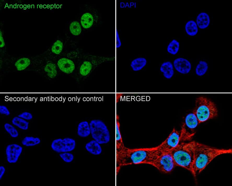 Immunocytochemistry/ Immunofluorescence: Androgen R/NR3C4 Antibody (PO00-29) [NBP3-32035] - Immunocytochemistry analysis of 22RV1 cells labeling Androgen R/NR3C4 with Rabbit anti-Androgen R/NR3C4 antibody (NBP3-32035) at 1/100 dilution. Cells were fixed in 4% paraformaldehyde for 20 minutes at room temperature, permeabilized with 0.1% Triton X-100 in PBS for 5 minutes at room temperature, then blocked with 1% BSA in 10% negative goat serum for 1 hour at room temperature. Cells were then incubated with Rabbit anti-Androgen R/NR3C4 antibody (NBP3-32035) at 1/100 dilution in 1% BSA in PBST overnight at 4 ℃. Goat Anti-Rabbit IgG H&L (iFluor™ 488) was used as the secondary antibody at 1/1,000 dilution. PBS instead of the primary antibody was used as the secondary antibody only control. Nuclear DNA was labelled in blue with DAPI. Beta tubulin (red) was stained at 1/100 dilution overnight at +4℃. Goat Anti-Mouse IgG H&L (iFluor™ 594) was used as the secondary antibody at 1/1,000 dilution.