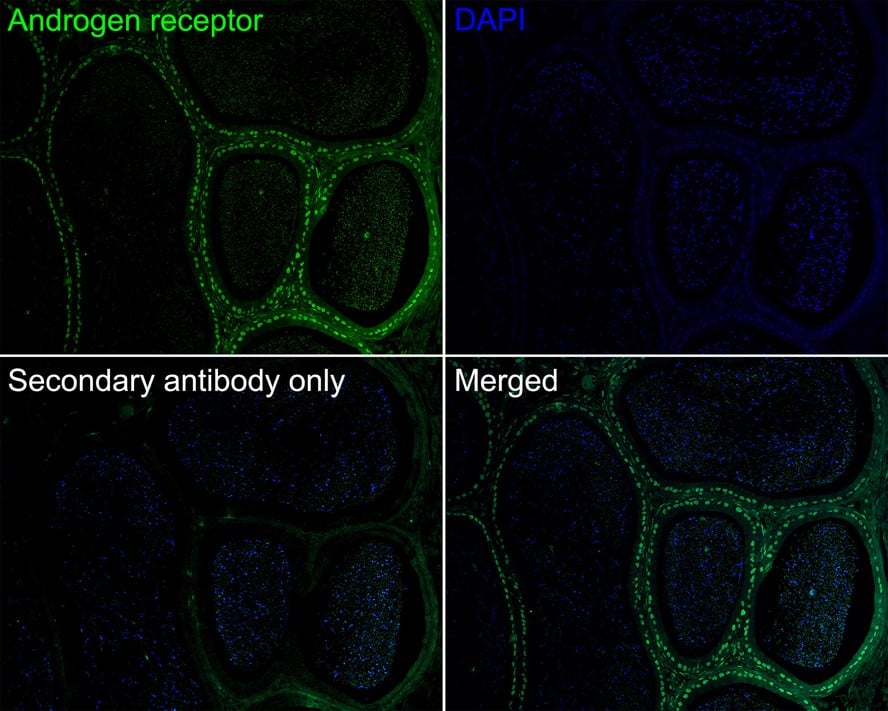 Immunohistochemistry: Androgen R/NR3C4 Antibody (PO00-29) [NBP3-32035] - Immunofluorescence analysis of paraffin-embedded rat epididymis tissue labeling Androgen R/NR3C4 with Rabbit anti-Androgen R/NR3C4 antibody (NBP3-32035) at 1/50 dilution. The section was pre-treated using heat mediated antigen retrieval with sodium citrate buffer (pH 6.0) for 2 minutes. The tissues were blocked in 10% negative goat serum for 1 hour at room temperature, washed with PBS, and then probed with the primary antibody (NBP3-32035, green) at 1/50 dilution overnight at 4 ℃, washed with PBS. Goat Anti-Rabbit IgG H&L (iFluor™ 488) was used as the secondary antibody at 1/1,000 dilution. Nuclei were counterstained with DAPI (blue).