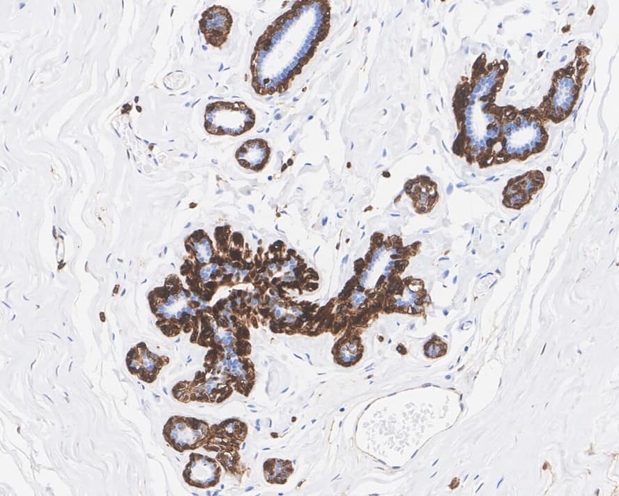 Immunohistochemistry: Annexin A1 Antibody (PSH04-13) [NBP3-32036] - Immunohistochemical analysis of paraffin-embedded human breast tissue with Rabbit anti-Annexin A1 antibody (NBP3-32036) at 1/500 dilution. The section was pre-treated using heat mediated antigen retrieval with Tris-EDTA buffer (pH 9.0) for 20 minutes. The tissues were blocked in 1% BSA for 20 minutes at room temperature, washed with ddH2O and PBS, and then probed with the primary antibody (NBP3-32036) at 1/500 dilution for 1 hour at room temperature. The detection was performed using an HRP conjugated compact polymer system. DAB was used as the chromogen. Tissues were counterstained with hematoxylin and mounted with DPX.