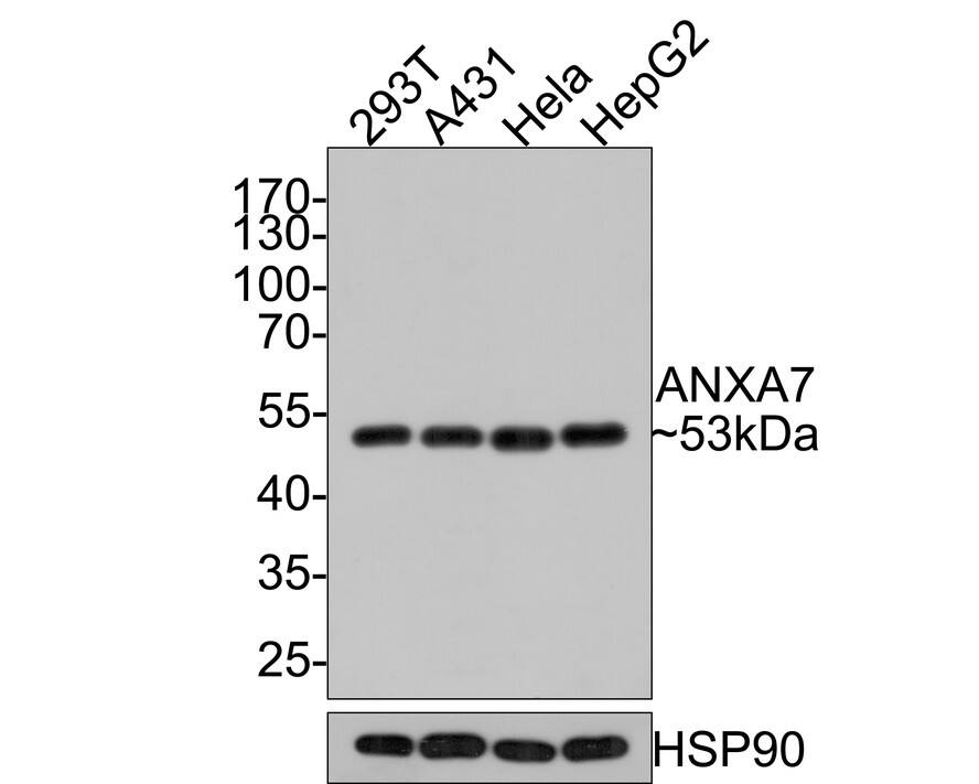 Western blot analysis on different lysates with NBP3-32038 at 1/500 dilution. Lane 1: 293T cell lysate Lane 2: A431 cell lysate Lane 1: Hela cell lysate Lane 2: HepG2 cell lysate Lysates/proteins at 10 µg/Lane. Predicted band size: 53 kDa Observed band size: 53 kDa Exposure time: 1 minute; 10% SDS-PAGE gel. Proteins were transferred to a PVDF membrane and blocked with 5% NFDM/TBST for 1 hour at room temperature. NBP3-32038 at 1/500 dilution was used in 5% NFDM/TBST at room temperature for 2 hours. Goat Anti-Rabbit IgG [HRP] Secondary Antibody at 1:300,000 dilution was used for 1 hour at room temperature.