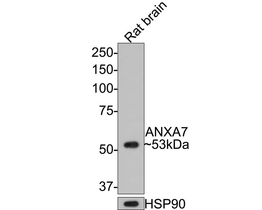 Western blot analysis of  rat brain tissue lysates with NBP3-32039 at 1/500 dilution. Lysates/proteins at 20 µg/Lane. Predicted band size: 53 kDa Observed band size: 53 kDa Exposure time: 1 minute; 8% SDS-PAGE gel. Proteins were transferred to a PVDF membrane and blocked with 5% NFDM/TBST for 1 hour at room temperature. NBP3-32039 at 1/500 dilution was used in 5% NFDM/TBST at room temperature for 2 hours. Goat Anti-Rabbit IgG [HRP] Secondary Antibody at 1:300,000 dilution was used for 1 hour at room temperature.