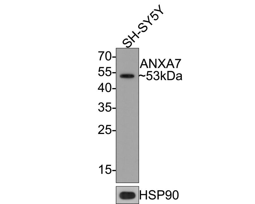 Western Blot: Annexin A7 Antibody (JE65-36) [NBP3-32039] - Western blot analysis of Annexin A7 on SH-SY5Y cell lysates with Rabbit anti-Annexin A7 antibody (NBP3-32039) at 1/500 dilution. Lysates/proteins at 10 ug/Lane. Predicted band size: 53 kDa Observed band size: 53 kDa Exposure time: 2 minutes; 12% SDS-PAGE gel. Proteins were transferred to a PVDF membrane and blocked with 5% NFDM/TBST for 1 hour at room temperature. The primary antibody (NBP3-32039) at 1/500 dilution was used in 5% NFDM/TBST at room temperature for 2 hours. Goat Anti-Rabbit IgG - HRP Secondary Antibody at 1:300,000 dilution was used for 1 hour at room temperature.