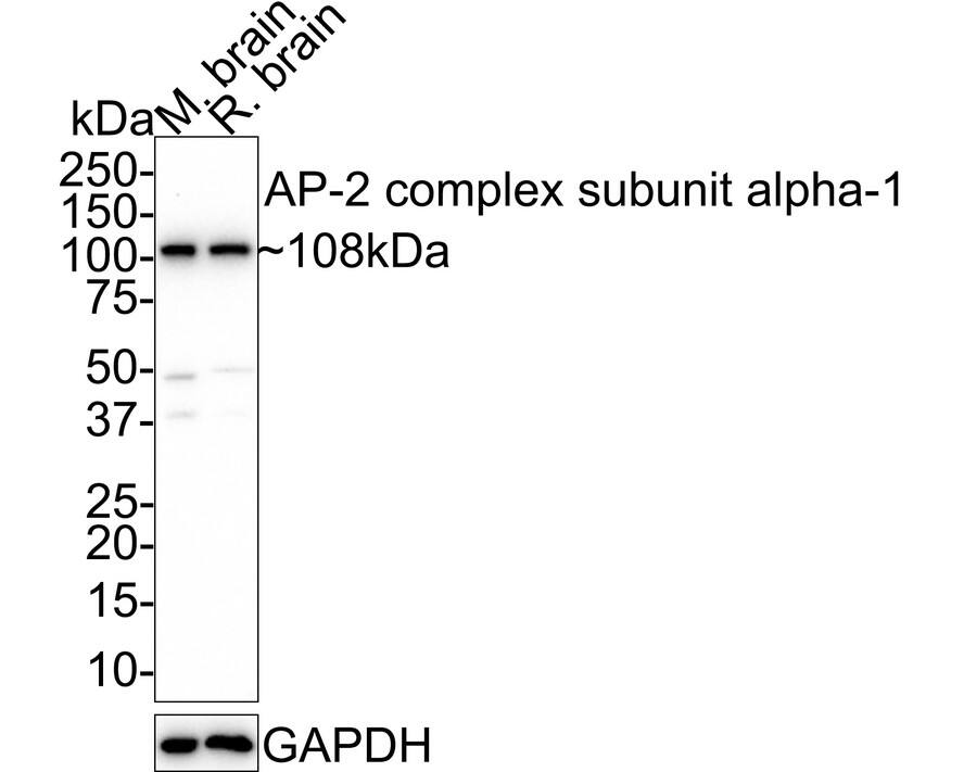 Western Blot: alpha Adaptin Antibody (JE40-38) [NBP3-32040] - Western blot analysis of alpha Adaptin on different lysates with Rabbit anti-alpha Adaptin antibody (NBP3-32040) at 1/1,000 dilution. Lane 1: Mouse brain tissue lysate Lane 2: Rat brain tissue lysate Lysates/proteins at 40 ug/Lane. Predicted band size: 108 kDa Observed band size: 108 kDa Exposure time: 10 minutes; 4-20% SDS-PAGE gel. Proteins were transferred to a PVDF membrane and blocked with 5% NFDM/TBST for 1 hour at room temperature. The primary antibody (NBP3-32040) at 1/1,000 dilution was used in 5% NFDM/TBST at room temperature for 2 hours. Goat Anti-Rabbit IgG - HRP Secondary Antibody at 1/50,000 dilution was used for 1 hour at room temperature.