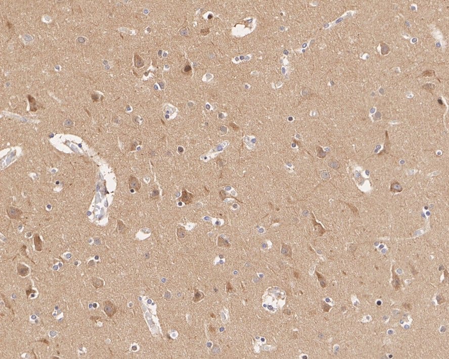 Immunohistochemistry: alpha Adaptin Antibody (JE40-38) [NBP3-32040] - Immunohistochemical analysis of paraffin-embedded human brain tissue with Rabbit anti-alpha Adaptin antibody (NBP3-32040) at 1/200 dilution. The section was pre-treated using heat mediated antigen retrieval with Tris-EDTA buffer (pH 9.0) for 20 minutes. The tissues were blocked in 1% BSA for 20 minutes at room temperature, washed with ddH2O and PBS, and then probed with the primary antibody (NBP3-32040) at 1/200 dilution for 1 hour at room temperature. The detection was performed using an HRP conjugated compact polymer system. DAB was used as the chromogen. Tissues were counterstained with hematoxylin and mounted with DPX.