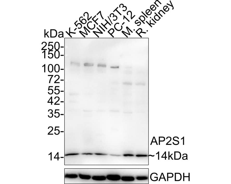 Western Blot: AP2S1 Antibody (JE47-37) [NBP3-32041] - Western blot analysis of AP2S1 on different lysates with Rabbit anti-AP2S1 antibody (NBP3-32041) at 1/1,000 dilution. Lane 1: K-562 cell lysate (30 ug/Lane) Lane 2: MCF7 cell lysate (30 ug/Lane) Lane 3: NIH/3T3 cell lysate (30 ug/Lane) Lane 4: PC-12 cell lysate (30 ug/Lane) Lane 5: Mouse spleen tissue lysate (40 ug/Lane) Lane 6: Rat kidney tissue lysate (40 ug/Lane) Predicted band size: 17 kDa Observed band size: 14 kDa Exposure time: 1 minute 6 seconds; 4-20% SDS-PAGE gel. Proteins were transferred to a PVDF membrane and blocked with 5% NFDM/TBST for 1 hour at room temperature. The primary antibody (NBP3-32041) at 1/1,000 dilution was used in 5% NFDM/TBST at 4C overnight. Goat Anti-Rabbit IgG - HRP Secondary Antibody at 1/50,000 dilution was used for 1 hour at room temperature.