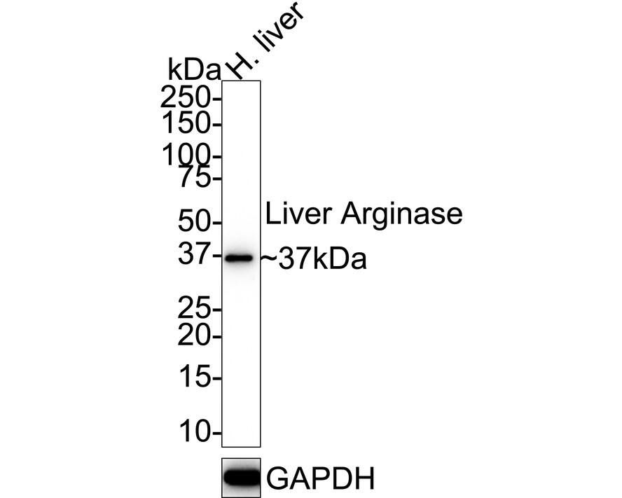 Western blot analysis of  human liver tissue lysates with NBP3-32047 at 1/2,000 dilution. Lysates/proteins at 20 µg/Lane. Predicted band size: 35 kDa Observed band size: 37 kDa Exposure time: 30 seconds;  4-20% SDS-PAGE gel. Proteins were transferred to a PVDF membrane and blocked with 5% NFDM/TBST for 1 hour at room temperature. NBP3-32047 at 1/2,000 dilution was used in 5% NFDM/TBST at 4℃ overnight. Goat Anti-Rabbit IgG [HRP] Secondary Antibody at 1/50,000 dilution was used for 1 hour at room temperature.