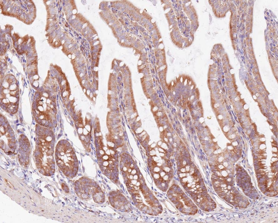 Immunohistochemistry: ASC1 Antibody (PSH0-26) [NBP3-32049] - Immunohistochemical analysis of paraffin-embedded rat small intestine tissue with Rabbit anti-ASC1 antibody (NBP3-32049) at 1/200 dilution. The section was pre-treated using heat mediated antigen retrieval with sodium citrate buffer (pH 6.0) for 2 minutes. The tissues were blocked in 1% BSA for 20 minutes at room temperature, washed with ddH2O and PBS, and then probed with the primary antibody (NBP3-32049) at 1/200 dilution for 1 hour at room temperature. The detection was performed using an HRP conjugated compact polymer system. DAB was used as the chromogen. Tissues were counterstained with hematoxylin and mounted with DPX.