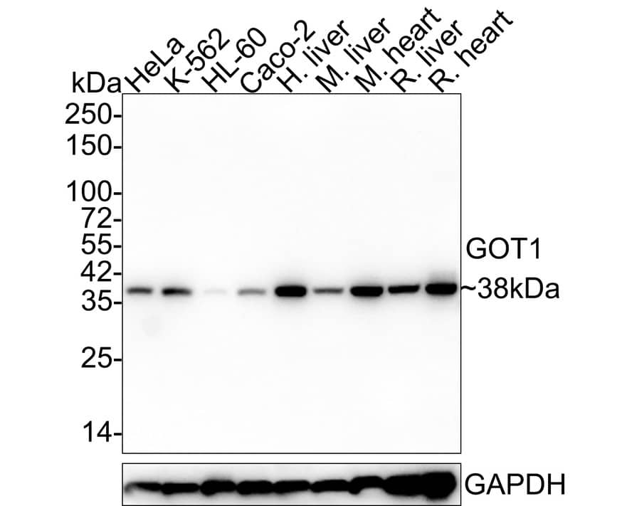 Western blot analysis on different lysates with NBP3-32050 at 1/1,000 dilution. Lane 1: HeLa cell lysate (20 µg/Lane) Lane 2: K-562 cell lysate (20 µg/Lane) Lane 3: HL-60 cell lysate (20 µg/Lane) Lane 4: Caco-2 cell lysate (20 µg/Lane) Lane 5: Human liver tissue lysate (40 µg/Lane) Lane 6: Mouse liver tissue lysate (40 µg/Lane) Lane 7: Mouse heart tissue lysate (40 µg/Lane) Lane 8: Rat liver tissue lysate (40 µg/Lane) Lane 9: Rat heart tissue lysate (40 µg/Lane) Lysates/proteins at 10 µg/Lane. Predicted band size: 46 kDa Observed band size: 38 kDa Exposure time: 1 minute 41 seconds; 4-20% SDS-PAGE gel. Proteins were transferred to a PVDF membrane and blocked with 5% NFDM/TBST for 1 hour at room temperature. NBP3-32050 at 1/1,000 dilution was used in 5% NFDM/TBST at 4℃ overnight. Goat anti-Mouse IgG [HRP] at 1/50,000 dilution was used for 1 hour at room temperature.