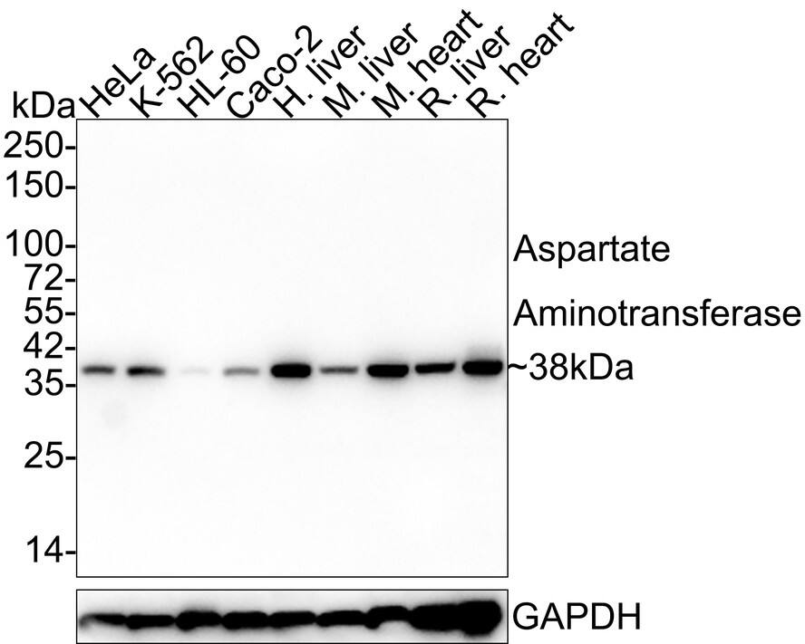 Western Blot: Aspartate Aminotransferase Antibody (A2D6-R) [NBP3-32050] - Western blot analysis of Aspartate Aminotransferase on different lysates with Mouse anti-Aspartate Aminotransferase antibody (NBP3-32050) at 1/1,000 dilution. Lane 1: HeLa cell lysate (20 ug/Lane) Lane 2: K-562 cell lysate (20 ug/Lane) Lane 3: HL-60 cell lysate (20 ug/Lane) Lane 4: Caco-2 cell lysate (20 ug/Lane) Lane 5: Human liver tissue lysate (40 ug/Lane) Lane 6: Mouse liver tissue lysate (40 ug/Lane) Lane 7: Mouse heart tissue lysate (40 ug/Lane) Lane 8: Rat liver tissue lysate (40 ug/Lane) Lane 9: Rat heart tissue lysate (40 ug/Lane) Lysates/proteins at 10 ug/Lane. Predicted band size: 46 kDa Observed band size: 38 kDa Exposure time: 1 minute 41 seconds; 4-20% SDS-PAGE gel. Proteins were transferred to a PVDF membrane and blocked with 5% NFDM/TBST for 1 hour at room temperature. The primary antibody (NBP3-32050) at 1/1,000 dilution was used in 5% NFDM/TBST at 4C overnight. Goat Anti-Mouse IgG - HRP Secondary Antibody at 1/50,000 dilution was used for 1 hour at room temperature.