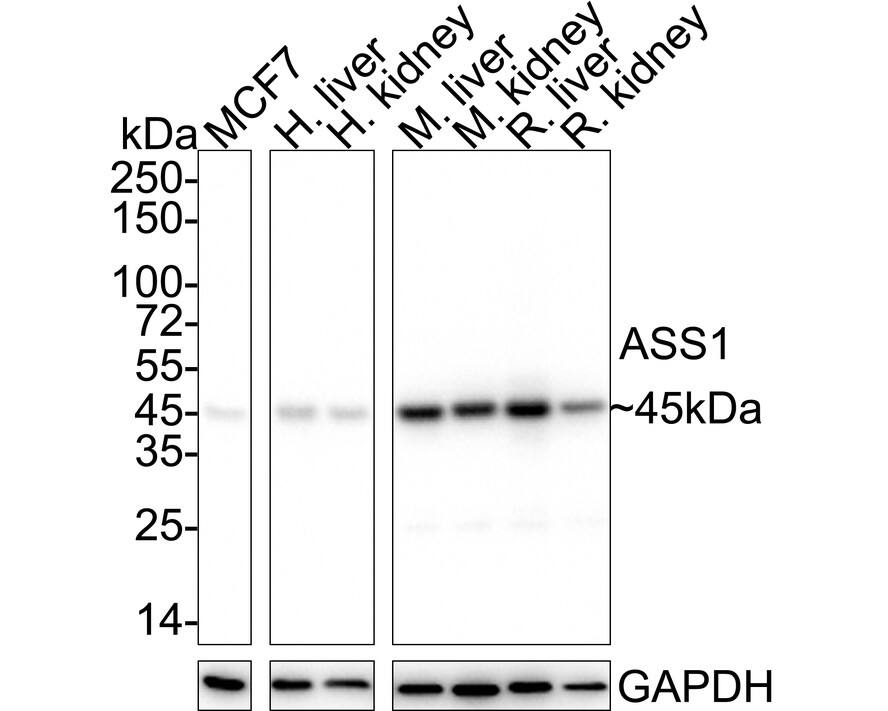 Western blot analysis on different lysates with NBP3-32051 at 1/5,000 dilution. Lane 1: HepG2 cell lysate (15 µg/Lane) Lane 2: Human liver tissue lysate (30 µg/Lane) Lane 3: Human kidney tissue lysate (30 µg/Lane) Lane 4: Mouse liver tissue lysate (30 µg/Lane) Lane 5: Mouse kidney tissue lysate (30 µg/Lane) Lane 6: Rat liver tissue lysate (30 µg/Lane) Lane 7: Rat kidney tissue lysate (30 µg/Lane) Predicted band size: 47 kDa Observed band size: 45 kDa Exposure time: 6 seconds;  4-20% SDS-PAGE gel. Proteins were transferred to a PVDF membrane and blocked with 5% NFDM/TBST for 1 hour at room temperature. NBP3-32051 at 1/5,000 dilution was used in 5% NFDM/TBST at 4℃ overnight. Goat anti-Mouse IgG [HRP] at 1/50,000 dilution was used for 1 hour at room temperature.