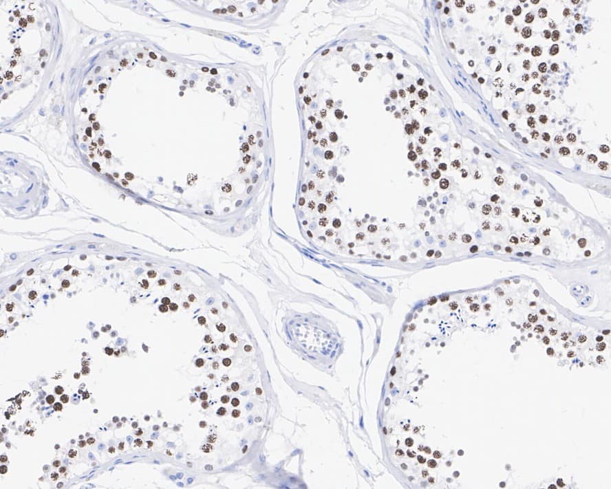 Immunohistochemistry: ATAD2 Antibody (JE34-52) [NBP3-32052] - Immunohistochemical analysis of paraffin-embedded human testis tissue with Rabbit anti-ATAD2 antibody (NBP3-32052) at 1/2,000 dilution. The section was pre-treated using heat mediated antigen retrieval with sodium citrate buffer (pH 6.0) for 2 minutes. The tissues were blocked in 1% BSA for 20 minutes at room temperature, washed with ddH2O and PBS, and then probed with the primary antibody (NBP3-32052) at 1/2,000 dilution for 1 hour at room temperature. The detection was performed using an HRP conjugated compact polymer system. DAB was used as the chromogen. Tissues were counterstained with hematoxylin and mounted with DPX.