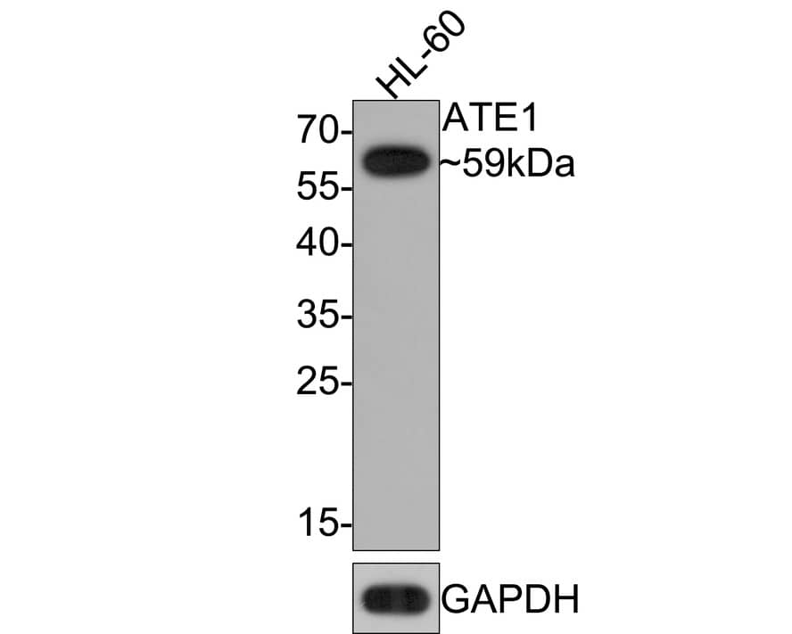 Western Blot: ATE1 Antibody (JE65-47) [NBP3-32053] - Western blot analysis of ATE1 on HL-60 cell lysates with Rabbit anti-ATE1 antibody (NBP3-32053) at 1/2,000  dilution. Lysates/proteins at 10 ug/Lane. Predicted band size: 59 kDa Observed band size: 59 kDa Exposure time: 2 minutes; 12% SDS-PAGE gel. Proteins were transferred to a PVDF membrane and blocked with 5% NFDM/TBST for 1 hour at room temperature. The primary antibody (NBP3-32053) at 1/2,000  dilution was used in 5% NFDM/TBST at room temperature for 2 hours. Goat Anti-Rabbit IgG - HRP Secondary Antibody at 1:300,000 dilution was used for 1 hour at room temperature.