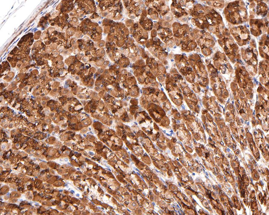 Immunohistochemistry: ATE1 Antibody (JE65-47) [NBP3-32053] - Immunohistochemical analysis of paraffin-embedded rat stomach tissue with Rabbit anti-ATE1 antibody (NBP3-32053) at 1/400 dilution. The section was pre-treated using heat mediated antigen retrieval with Tris-EDTA buffer (pH 9.0) for 20 minutes. The tissues were blocked in 1% BSA for 20 minutes at room temperature, washed with ddH2O and PBS, and then probed with the primary antibody (NBP3-32053) at 1/400 dilution for 1 hour at room temperature. The detection was performed using an HRP conjugated compact polymer system. DAB was used as the chromogen. Tissues were counterstained with hematoxylin and mounted with DPX.