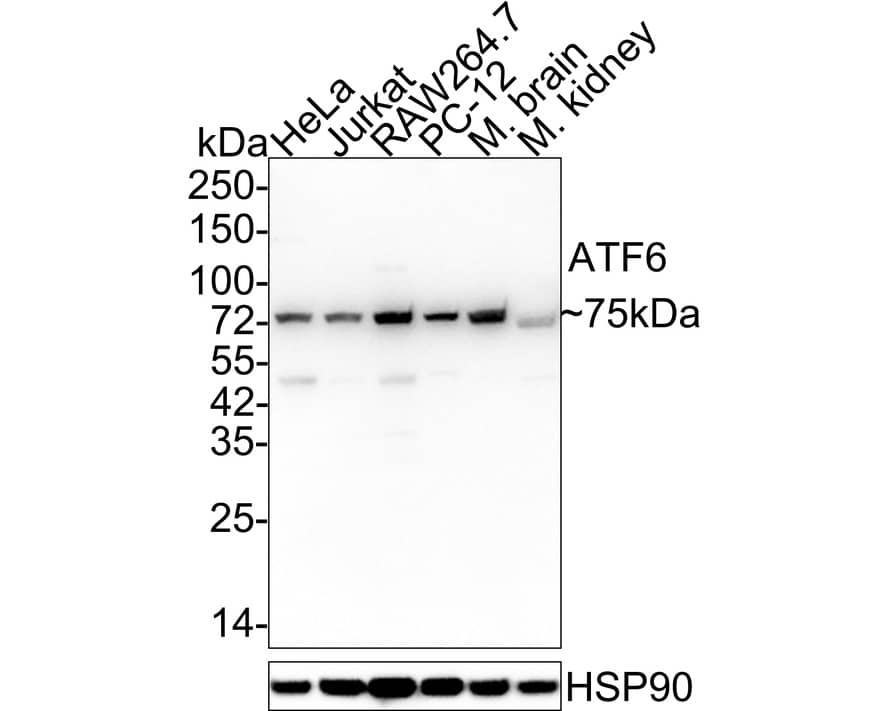 Western blot analysis on different lysates with NBP3-32054 at 1/1,000 dilution. Lane 1: HeLa cell lysate (20 µg/Lane) Lane 2: Jurkat cell lysate (20 µg/Lane) Lane 3: RAW264.7 cell lysate (20 µg/Lane) Lane 4: PC-12 cell lysate (20 µg/Lane) Lane 5: Mouse brain tissue lysate (40 µg/Lane) Lane 6: Mouse kidney tissue lysate (40 µg/Lane) Predicted band size: 75 kDa Observed band size: 75 kDa Exposure time: 1 minute 21 seconds; 4-20% SDS-PAGE gel. Proteins were transferred to a PVDF membrane and blocked with 5% NFDM/TBST for 1 hour at room temperature. NBP3-32054 at 1/1,000 dilution was used in 5% NFDM/TBST at 4℃ overnight. Goat anti-Mouse IgG [HRP] at 1/50,000 dilution was used for 1 hour at room temperature.