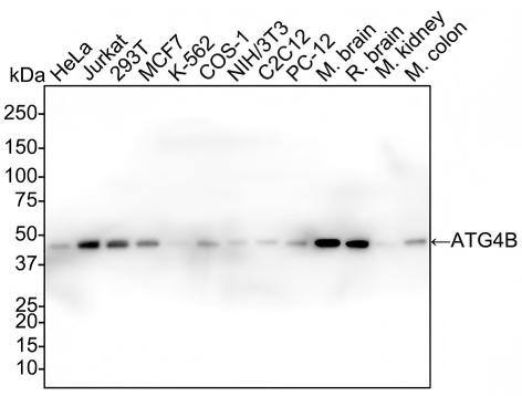 Western blot analysis on different lysates with NBP3-32058 at 1/2,000 dilution and competitor's antibody at 1/2,000 dilution. Lane 1: HeLa cell lysate Lane 2: Jurkat cell lysate Lane 3: 293T cell lysate Lane 4: MCF7 cell lysate Lane 5: K-562 cell lysate Lane 6: COS-1 cell lysate Lane 7: NIH/3T3 cell lysate Lane 8: C2C12 cell lysate Lane 9: PC-12 cell lysate Lane 10: Mouse brain tissue lysate Lane 11: Rat brain tissue lysate Lane 12: Mouse kidney tissue lysate Lane 13: Mouse colon tissue lysate Lysates/proteins at 30 µg/Lane. Predicted band size: 44 kDa Observed band size: 47 kDa Exposure time: 42 seconds; 4-20% SDS-PAGE gel. Proteins were transferred to a PVDF membrane and blocked with 5% NFDM/TBST for 1 hour at room temperature. NBP3-32058 at 1/2,000 dilution and competitor's antibody at 1/2,000 dilution were used in 5% NFDM/TBST at 4℃ overnight. Goat Anti-Rabbit IgG [HRP] Secondary Antibody at 1/50,000 dilution was used for 1 hour at room temperature.