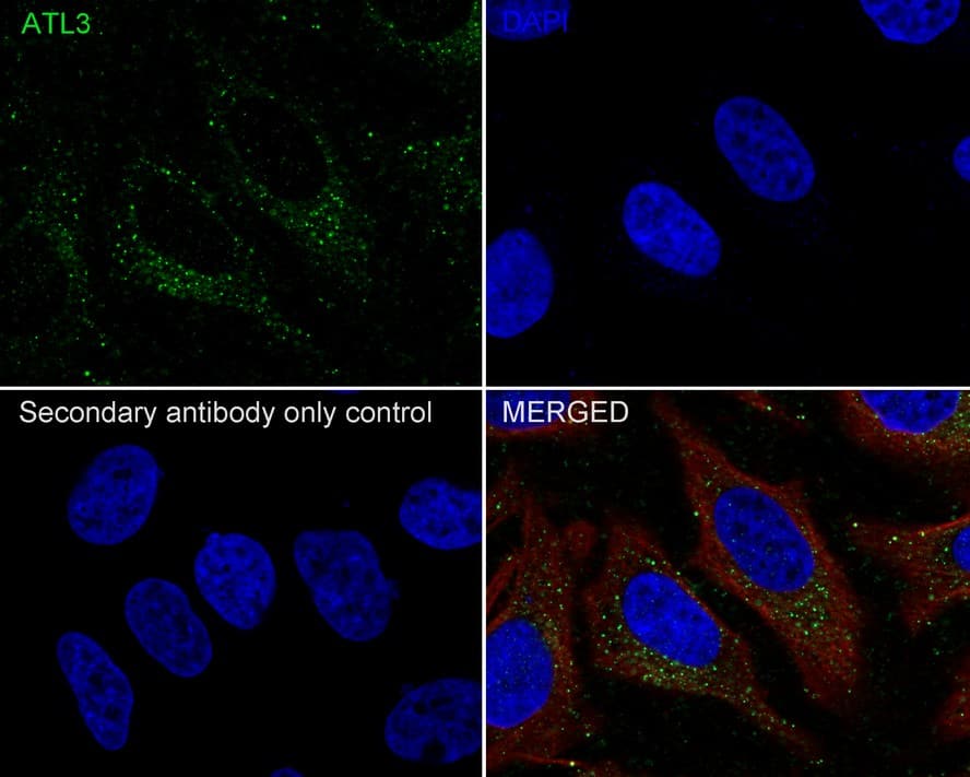 Immunocytochemistry/ Immunofluorescence: Atlastin-3 Antibody (PSH02-47) [NBP3-32060] - Immunocytochemistry analysis of HeLa cells labeling Atlastin-3 with Rabbit anti-Atlastin-3 antibody (NBP3-32060) at 1/100 dilution. Cells were fixed in 4% paraformaldehyde for 20 minutes at room temperature, permeabilized with 0.1% Triton X-100 in PBS for 5 minutes at room temperature, then blocked with 1% BSA in 10% negative goat serum for 1 hour at room temperature. Cells were then incubated with Rabbit anti-Atlastin-3 antibody (NBP3-32060) at 1/100 dilution in 1% BSA in PBST overnight at 4 ℃. Goat Anti-Rabbit IgG H&L (iFluor™ 488) was used as the secondary antibody at 1/1,000 dilution. PBS instead of the primary antibody was used as the secondary antibody only control. Nuclear DNA was labelled in blue with DAPI. Beta tubulin (red) was stained at 1/100 dilution overnight at +4℃. Goat Anti-Mouse IgG H&L (iFluor™ 594) was used as the secondary antibody at 1/1,000 dilution.