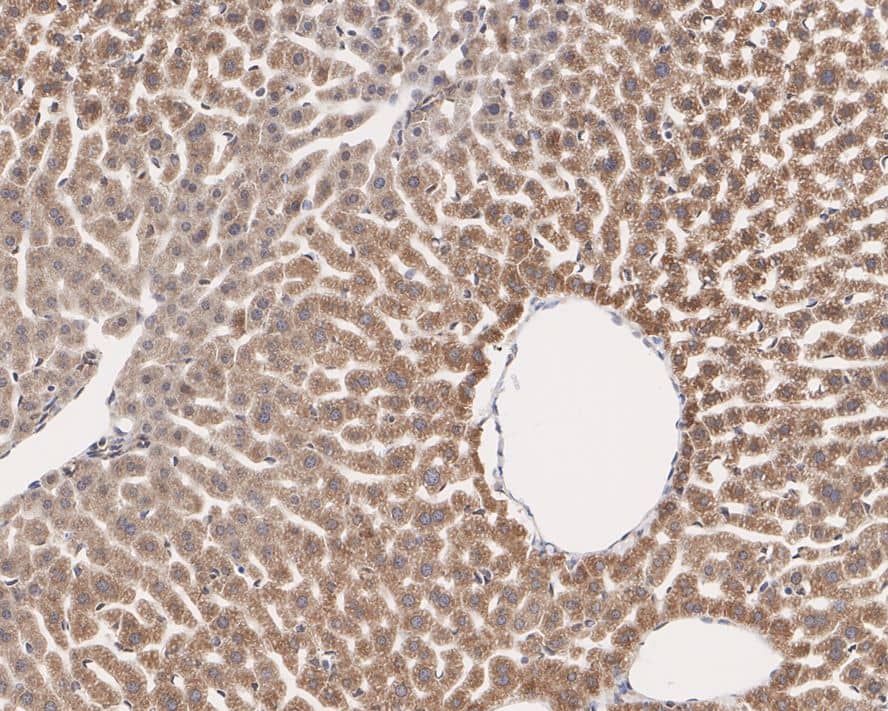 Immunohistochemistry: Atlastin-3 Antibody (PSH02-47) [NBP3-32060] - Immunohistochemical analysis of paraffin-embedded mouse liver tissue with Rabbit anti-Atlastin-3 antibody (NBP3-32060) at 1/1,000 dilution. The section was pre-treated using heat mediated antigen retrieval with Tris-EDTA buffer (pH 9.0) for 20 minutes. The tissues were blocked in 1% BSA for 20 minutes at room temperature, washed with ddH2O and PBS, and then probed with the primary antibody (NBP3-32060) at 1/1,000 dilution for 1 hour at room temperature. The detection was performed using an HRP conjugated compact polymer system. DAB was used as the chromogen. Tissues were counterstained with hematoxylin and mounted with DPX.