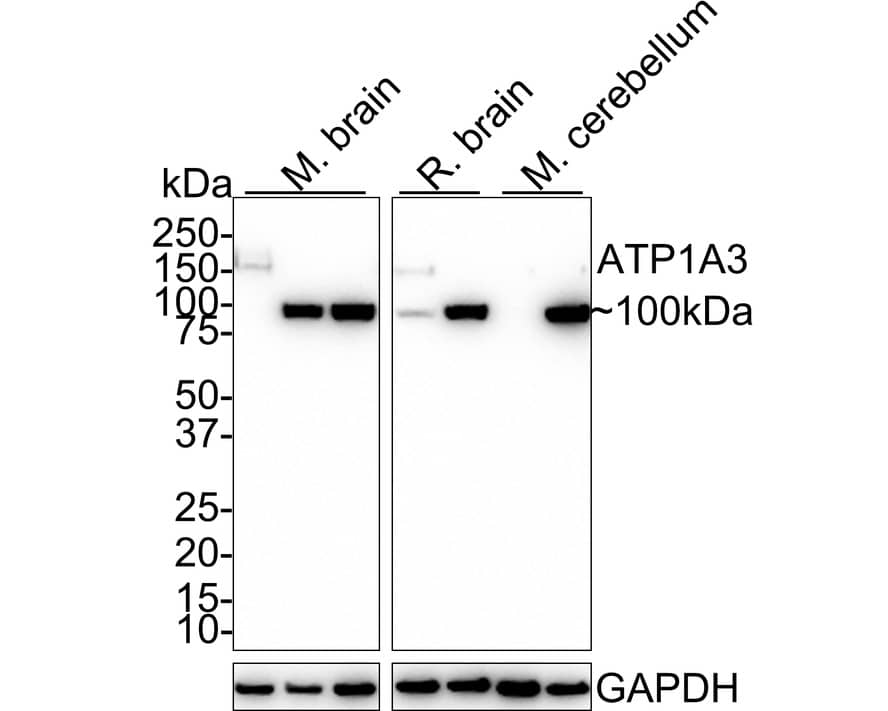 Western Blot: Sodium Potassium ATPase Alpha 3 Antibody (JE35-24) [NBP3-32062] - Western blot analysis of Sodium Potassium ATPase Alpha 3 on different lysates with Rabbit anti-Sodium Potassium ATPase Alpha 3 antibody (NBP3-32062) at 1/1,000 dilution. Lane 1: Mouse brain tissue lysate Lane 2: Mouse brain tissue lysate (70  heat) Lane 3: Mouse brain tissue lysate (no heat) Lane 4: Rat brain tissue lysate Lane 5: Rat brain tissue lysate (no heat) Lane 6: Mouse cerebellum tissue lysate Lane 7: Mouse cerebellum tissue lysate (70  heat) Lysates/proteins at 30 ug/Lane. Predicted band size: 112 kDa Observed band size: 100/150 kDa Exposure time: 2 minutes; 4-20% SDS-PAGE gel. Proteins were transferred to a PVDF membrane and blocked with 5% NFDM/TBST for 1 hour at room temperature. The primary antibody (NBP3-32062) at 1/1,000 dilution was used in 5% NFDM/TBST at room temperature for 2 hours. Goat Anti-Rabbit IgG - HRP Secondary Antibody at 1:50,000 dilution was used for 1 hour at room temperature.