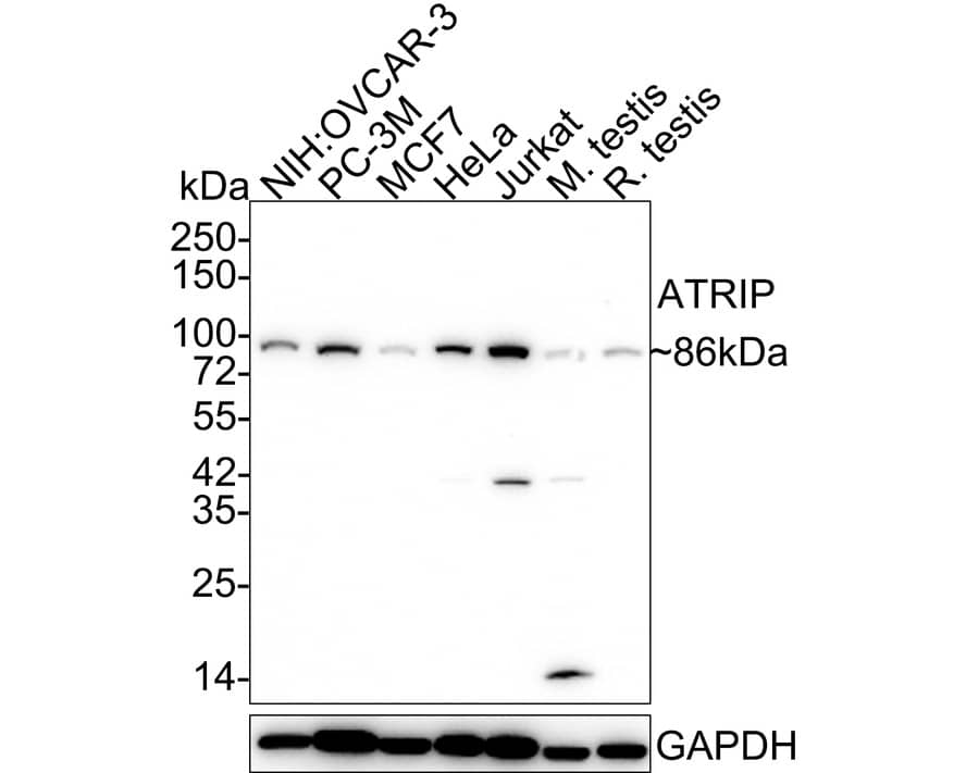 Western Blot: ATRIP Antibody (JE54-71) [NBP3-32063] - Western blot analysis of ATRIP on different lysates with Rabbit anti-ATRIP antibody (NBP3-32063) at 1/1,000 dilution. Lane 1: NIH:OVCAR-3 cell lysate (20 ug/Lane) Lane 2: PC-3M cell lysate (20 ug/Lane) Lane 3: MCF7 cell lysate (20 ug/Lane) Lane 4: HeLa cell lysate (20 ug/Lane) Lane 5: Jurkat cell lysate (20 ug/Lane) Lane 6: Mouse testis tissue lysate (30 ug/Lane) Lane 7: Rat testis tissue lysate (30 ug/Lane) Predicted band size: 86 kDa Observed band size: 86 kDa Exposure time: 3 minutes; 4-20% SDS-PAGE gel. Proteins were transferred to a PVDF membrane and blocked with 5% NFDM/TBST for 1 hour at room temperature. The primary antibody (NBP3-32063) at 1/1,000 dilution was used in 5% NFDM/TBST at 4C overnight. Goat Anti-Rabbit IgG - HRP Secondary Antibody at 1/50,000 dilution was used for 1 hour at room temperature.