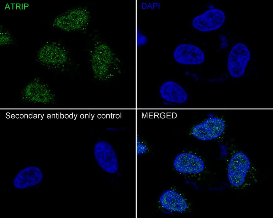 Immunocytochemistry/ Immunofluorescence: ATRIP Antibody (JE54-71) [NBP3-32063] - Immunocytochemistry analysis of HeLa cells labeling ATRIP with Rabbit anti-ATRIP antibody (NBP3-32063) at 1/100 dilution. Cells were fixed in 4% paraformaldehyde for 20 minutes at room temperature, permeabilized with 0.1% Triton X-100 in PBS for 5 minutes at room temperature, then blocked with 1% BSA in 10% negative goat serum for 1 hour at room temperature. Cells were then incubated with Rabbit anti-ATRIP antibody (NBP3-32063) at 1/100 dilution in 1% BSA in PBST overnight at 4 ℃. Goat Anti-Rabbit IgG H&L (iFluor™ 488) was used as the secondary antibody at 1/1,000 dilution. PBS instead of the primary antibody was used as the secondary antibody only control. Nuclear DNA was labelled in blue with DAPI.