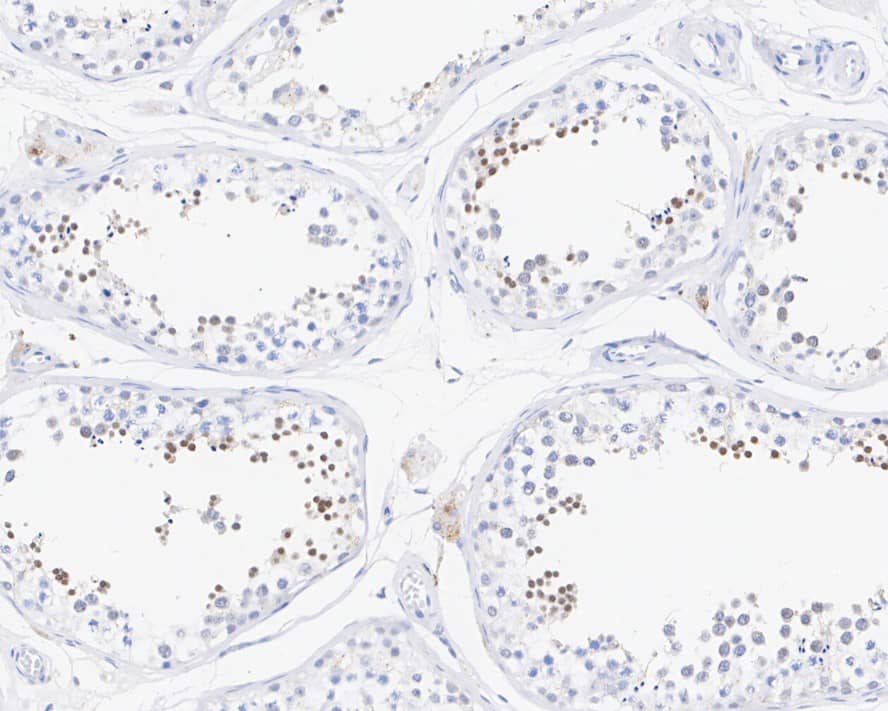 Immunohistochemistry: ATRIP Antibody (JE54-71) [NBP3-32063] - Immunohistochemical analysis of paraffin-embedded human testis tissue with Rabbit anti-ATRIP antibody (NBP3-32063) at 1/500 dilution. The section was pre-treated using heat mediated antigen retrieval with sodium citrate buffer (pH 6.0) for 2 minutes. The tissues were blocked in 1% BSA for 20 minutes at room temperature, washed with ddH2O and PBS, and then probed with the primary antibody (NBP3-32063) at 1/500 dilution for 1 hour at room temperature. The detection was performed using an HRP conjugated compact polymer system. DAB was used as the chromogen. Tissues were counterstained with hematoxylin and mounted with DPX.