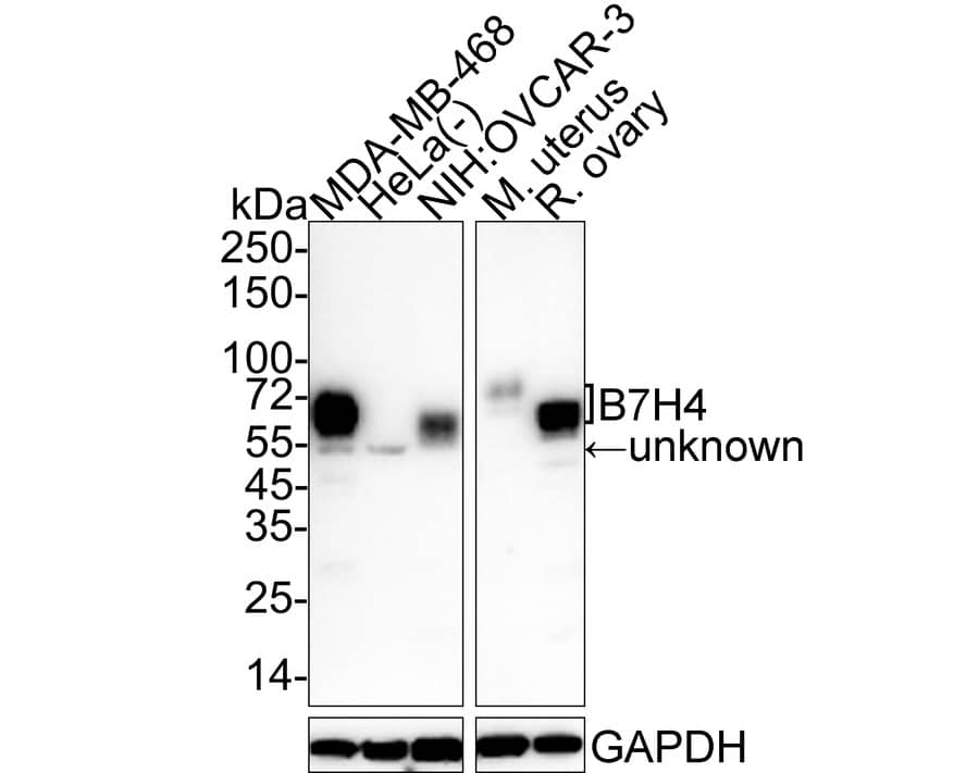 Western Blot: B7-H4 Antibody (PSH03-65) [NBP3-32065] - Western blot analysis of B7-H4 on different lysates with Rabbit anti-B7-H4 antibody (NBP3-32065) at 1/1,000 dilution. Lane 1: MDA-MB-468 cell lysate (no heat) (15 ug/Lane) Lane 2: HeLa cell lysate (negative) (30 ug/Lane) Lane 3: NIH:OVCAR-3 cell lysate (30 ug/Lane) Lane 4: Mouse uterus tissue lysate (30 ug/Lane) Lane 5: Rat ovary tissue lysate (15 ug/Lane) Predicted band size: 31 kDa Observed band size: 60-75 kDa Exposure time: 35 seconds; 4-20% SDS-PAGE gel. Proteins were transferred to a PVDF membrane and blocked with 5% NFDM/TBST for 1 hour at room temperature. The primary antibody (NBP3-32065) at 1/1,000 dilution was used in 5% NFDM/TBST at 4C overnight. Goat Anti-Rabbit IgG - HRP Secondary Antibody at 1/50,000 dilution was used for 1 hour at room temperature.