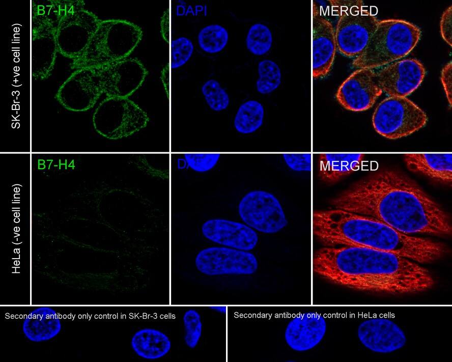 Immunocytochemistry/ Immunofluorescence: B7-H4 Antibody (PSH03-65) [NBP3-32065] - Immunocytochemistry analysis of SK-Br-3 (positive) and HeLa (negative) labeling B7-H4 with Rabbit anti-B7-H4 antibody (NBP3-32065) at 1/1,000 dilution. Cells were fixed in 4% paraformaldehyde for 20 minutes at room temperature, permeabilized with 0.1% Triton X-100 in PBS for 5 minutes at room temperature, then blocked with 1% BSA in 10% negative goat serum for 1 hour at room temperature. Cells were then incubated with Rabbit anti-B7-H4 antibody (NBP3-32065) at 1/1,000 dilution in 1% BSA in PBST overnight at 4 ℃. Goat Anti-Rabbit IgG H&L (iFluor™ 488) was used as the secondary antibody at 1/1,000 dilution. PBS instead of the primary antibody was used as the secondary antibody only control. Nuclear DNA was labelled in blue with DAPI. Beta tubulin (red) was stained at 1/100 dilution overnight at +4℃. Goat Anti-Mouse IgG H&L (iFluor™ 594) was used as the secondary antibody at 1/1,000 dilution.