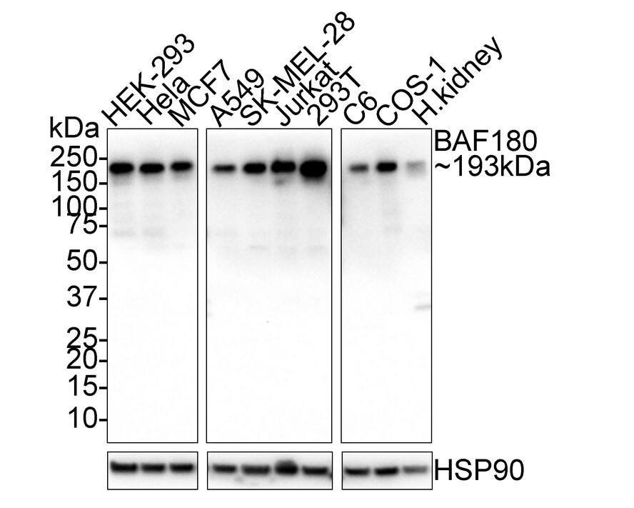 Western blot analysis on different lysates with NBP3-32067 at 1/1,000 dilution. Lane 1: HEK-293 cell lysate (20 µg/Lane) Lane 2: HeLa cell lysate (20 µg/Lane) Lane 3: MCF7 cell lysate (20 µg/Lane) Lane 4: A549 cell lysate (20 µg/Lane) Lane 5: SK-MEL-28 cell lysate (20 µg/Lane) Lane 6: Jurkat cell lysate (20 µg/Lane) Lane 7: 293T cell lysate (20 µg/Lane) Lane 8: C6 cell lysate (20 µg/Lane) Lane 9: COS-1 cell lysate (20 µg/Lane) Lane 10: Human kidney tissue lysate (40 µg/Lane) Predicted band size: 193 kDa Observed band size: 193 kDa Exposure time: 1 minute 41 seconds; 4-20% SDS-PAGE gel. Proteins were transferred to a PVDF membrane and blocked with 5% NFDM/TBST for 1 hour at room temperature. NBP3-32067 at 1/1,000 dilution was used in 5% NFDM/TBST at 4℃ overnight. Goat Anti-Rabbit IgG [HRP] Secondary Antibody at 1/50,000 dilution was used for 1 hour at room temperature.