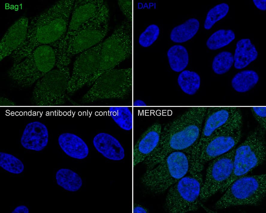 Immunocytochemistry/ Immunofluorescence: Bag-1 Antibody (JE63-22) [NBP3-32068] - Immunocytochemistry analysis of HeLa cells labeling Bag-1 with Rabbit anti-Bag-1 antibody (NBP3-32068) at 1/100 dilution. Cells were fixed in 4% paraformaldehyde for 20 minutes at room temperature, permeabilized with 0.1% Triton X-100 in PBS for 5 minutes at room temperature, then blocked with 1% BSA in 10% negative goat serum for 1 hour at room temperature. Cells were then incubated with Rabbit anti-Bag-1 antibody (NBP3-32068) at 1/100 dilution in 1% BSA in PBST overnight at 4 ℃. Goat Anti-Rabbit IgG H&L (iFluor™ 488) was used as the secondary antibody at 1/1,000 dilution. PBS instead of the primary antibody was used as the secondary antibody only control. Nuclear DNA was labelled in blue with DAPI.