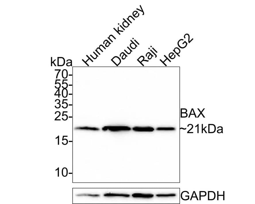 Western Blot: Bax Antibody (PSH0-20) [NBP3-32069] - Western blot analysis of Bax on different lysates with Mouse anti-Bax antibody (NBP3-32069) at 1/5,000 dilution. Lane 1: Human kidney tissue lysate (30 ug/Lane) Lane 2: Daudi cell lysate (15 ug/Lane) Lane 3: Raji cell lysate (15 ug/Lane) Lane 4: HepG2 cell lysate (15 ug/Lane) Predicted band size: 21 kDa Observed band size: 21 kDa Exposure time: 30 seconds; 15% SDS-PAGE gel. Proteins were transferred to a PVDF membrane and blocked with 5% NFDM/TBST for 1 hour at room temperature. The primary antibody (NBP3-32069) at 1/5,000 dilution was used in 5% NFDM/TBST at room temperature for 2 hours. Goat Anti-Mouse IgG - HRP Secondary Antibody at 1:150,000 dilution was used for 1 hour at room temperature.