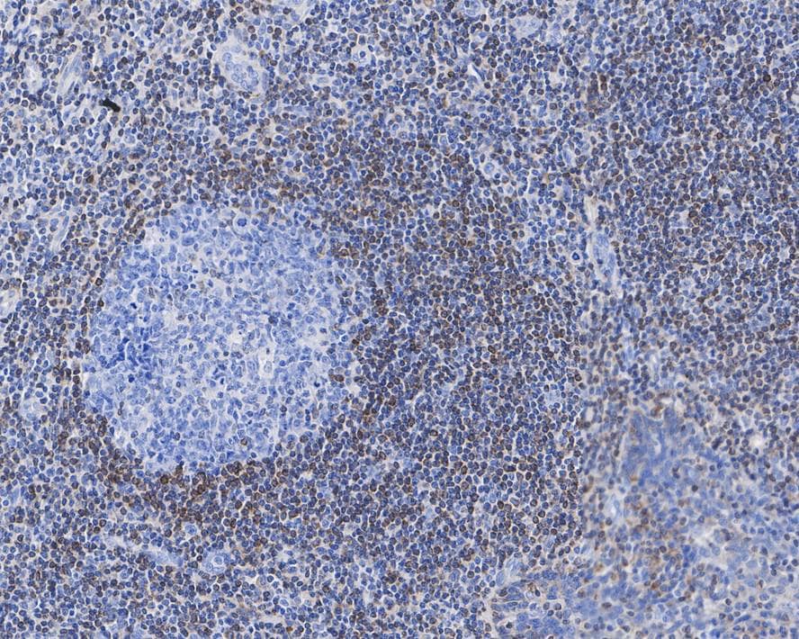 Immunohistochemistry: Bcl-2 Antibody (9F3-R) [NBP3-32072] - Immunohistochemical analysis of paraffin-embedded human tonsil tissue with Mouse anti-Bcl-2 antibody (NBP3-32072) at 1/500 dilution. The section was pre-treated using heat mediated antigen retrieval with Tris-EDTA buffer (pH 9.0) for 20 minutes. The tissues were blocked in 1% BSA for 20 minutes at room temperature, washed with ddH2O and PBS, and then probed with the primary antibody (NBP3-32072) at 1/500 dilution for 1 hour at room temperature. The detection was performed using an HRP conjugated compact polymer system. DAB was used as the chromogen. Tissues were counterstained with hematoxylin and mounted with DPX.